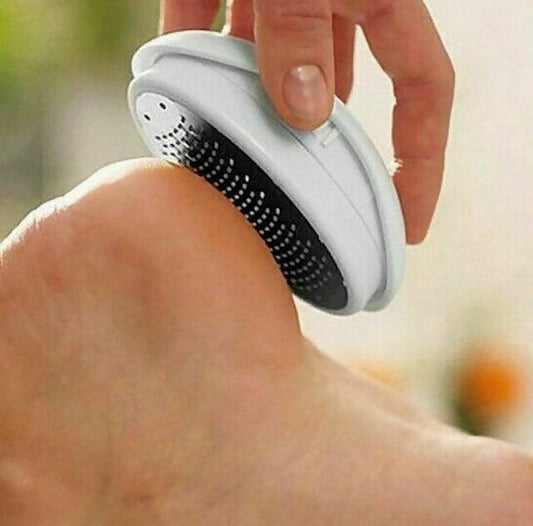 Egg Shaped Callous Remover: Durable, Ergonomic Design, Safe Skin Exfoliation